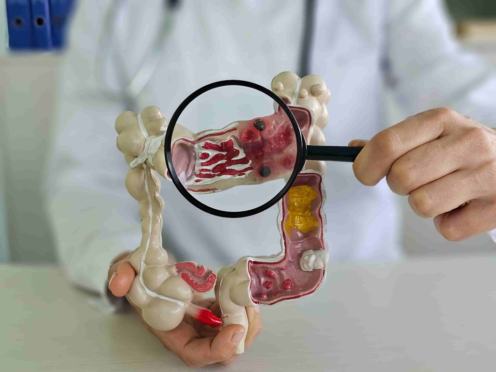 Colorectal Surgeon in Los Angeles
