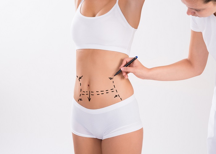 Achieve the Perfect Shape: Top Liposuction Surgery Clinics in Dubai