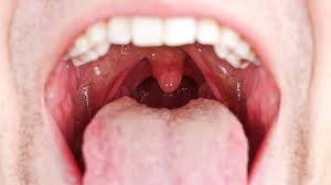 Saliva and Oral Health