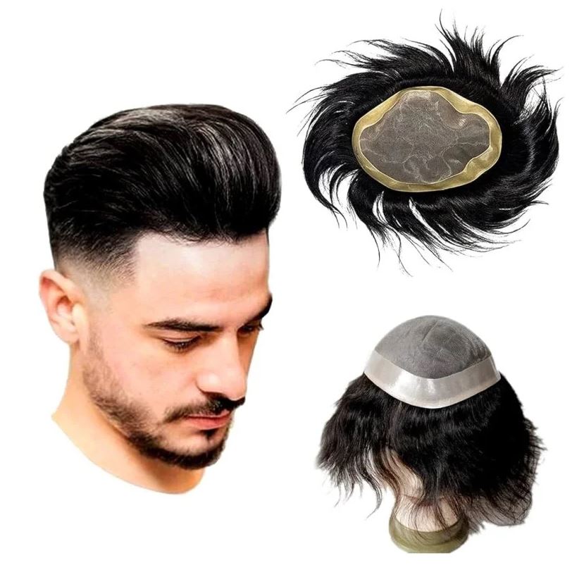 Men’s Hair Replacement