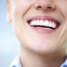 Gum Contouring in Riyadh