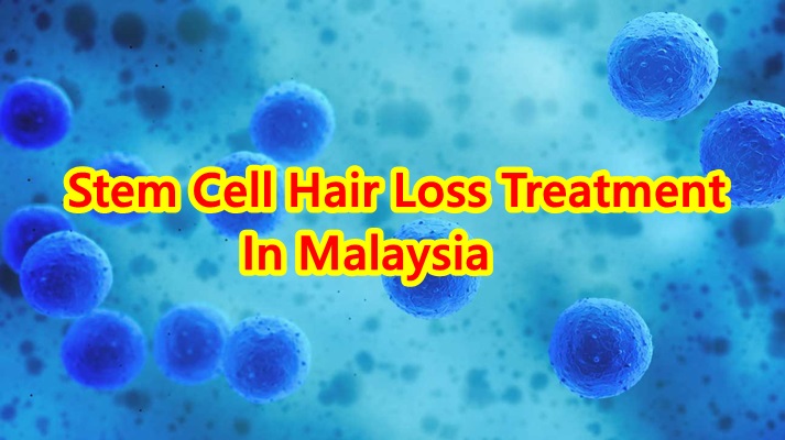 stem cell hair transplant singapore