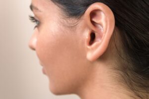 ear reshaping in Dubai