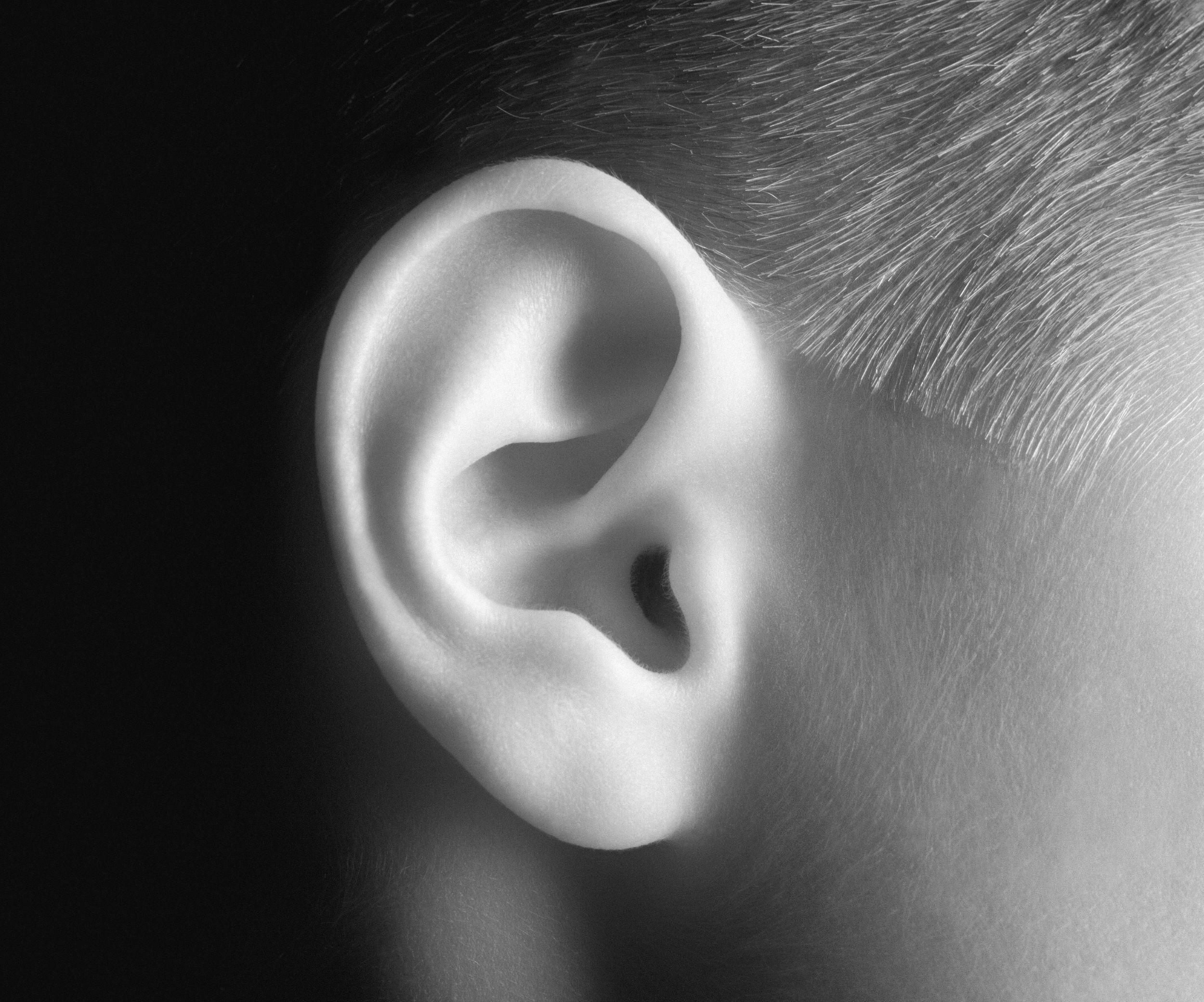 ear reshaping in Dubai
