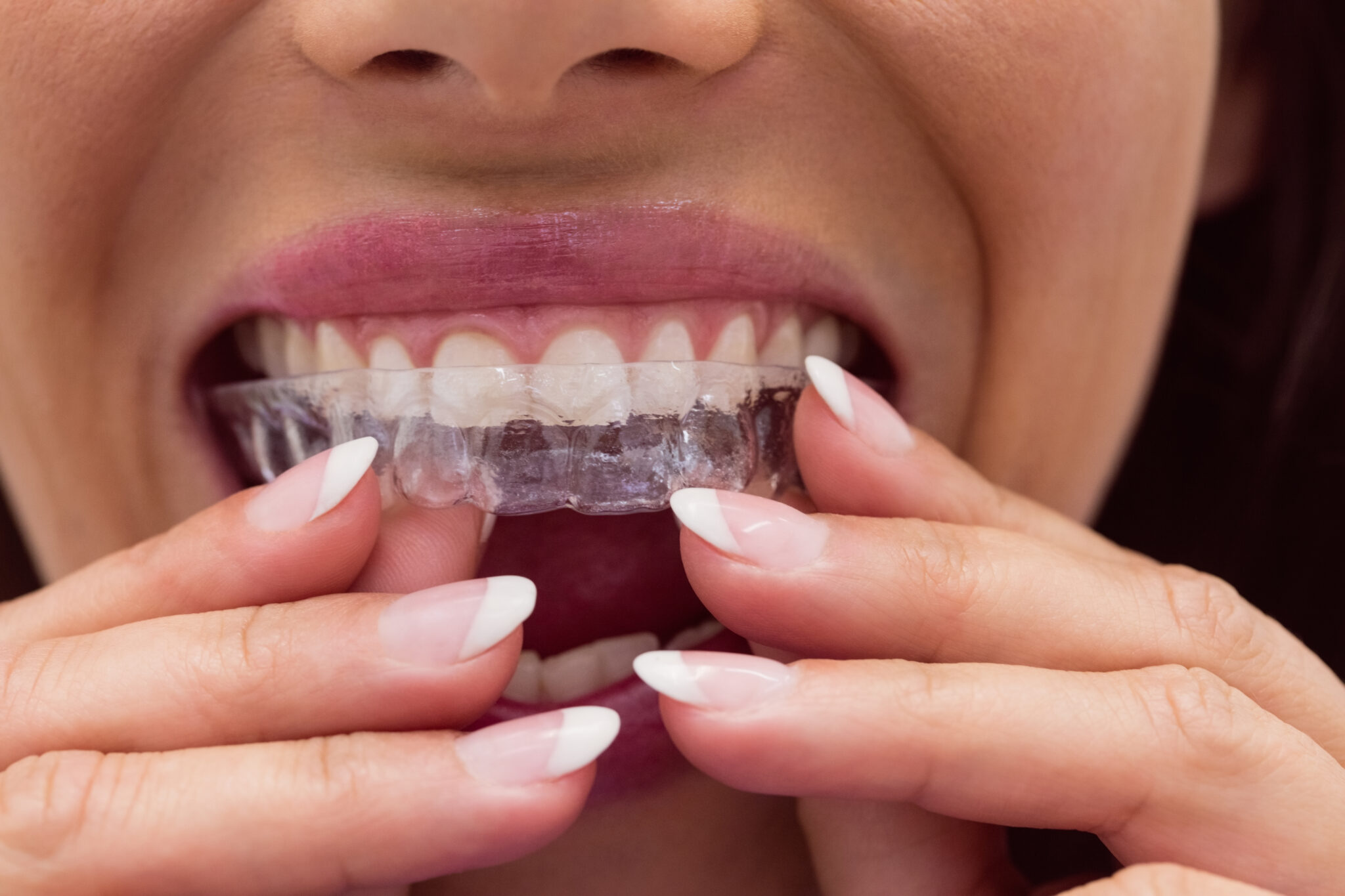 dental care in milton