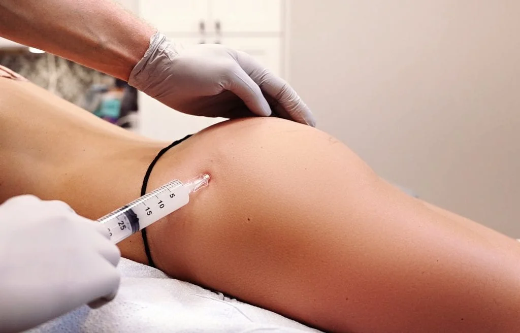 butt and body fillers in Dubai