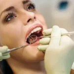 wisdom teeth removal Alexandria