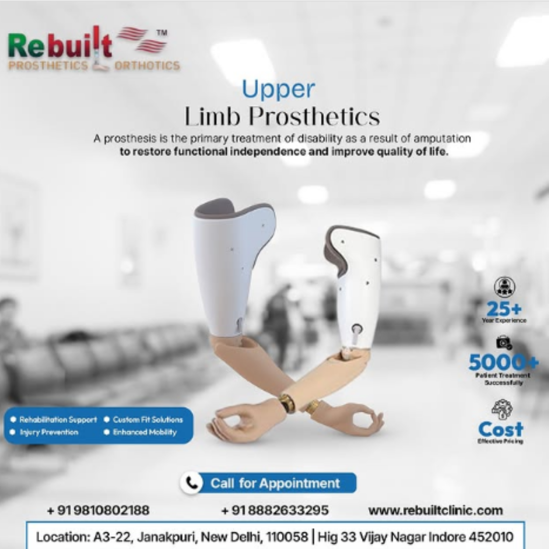 Upper Limb Prosthetics