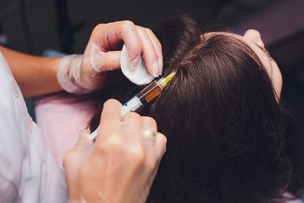 Best PRP Hair Treatment in Dubai