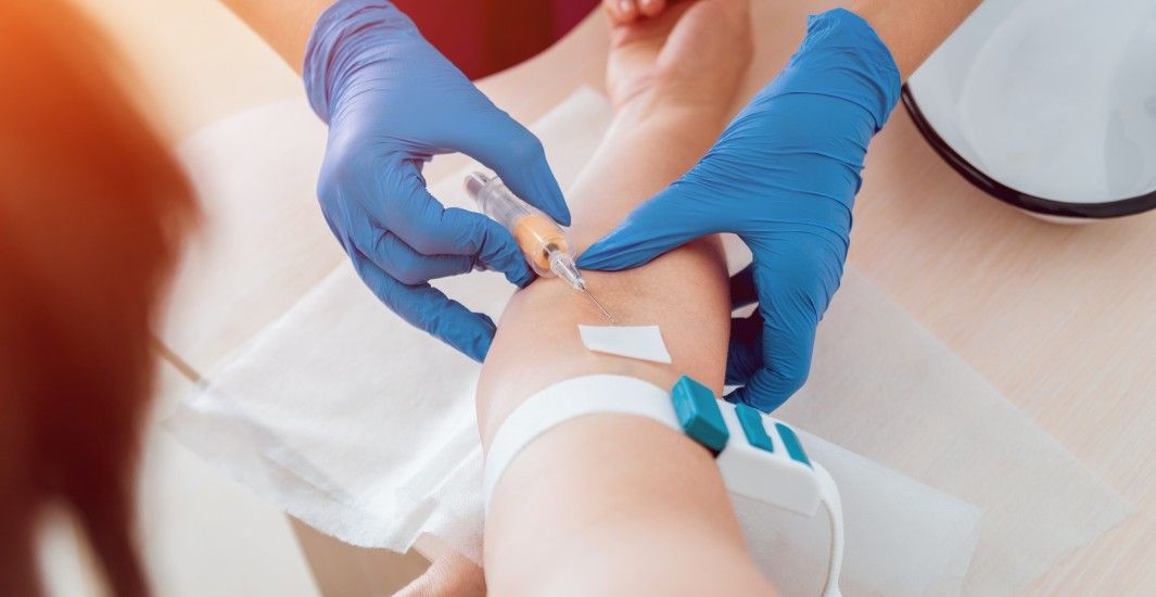 Vitamin D Tests at home in Dubai
