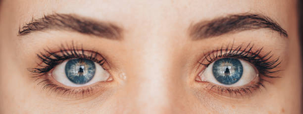 Eyelid Surgery in Riyadh