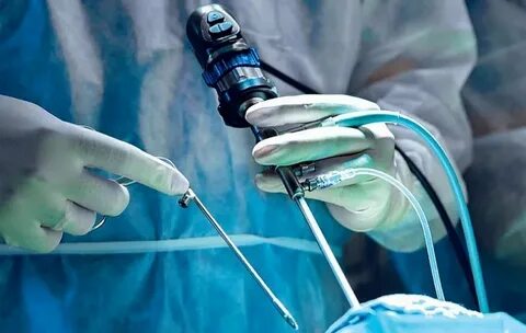 gastric bypass surgery, weight loss surgeon, colonoscopy screening, gallbladder removal