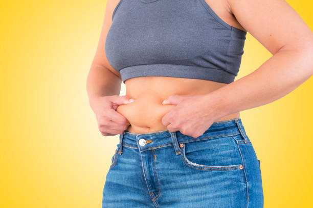 Does Tummy Tuck Surgery Help With Stretch Marks?