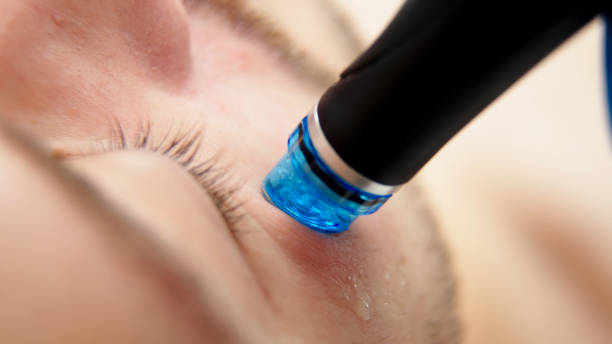 What Results to Expect After a HydraFacial Session