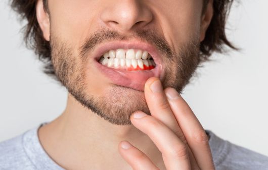 amoxicillin dose for tooth infection adult