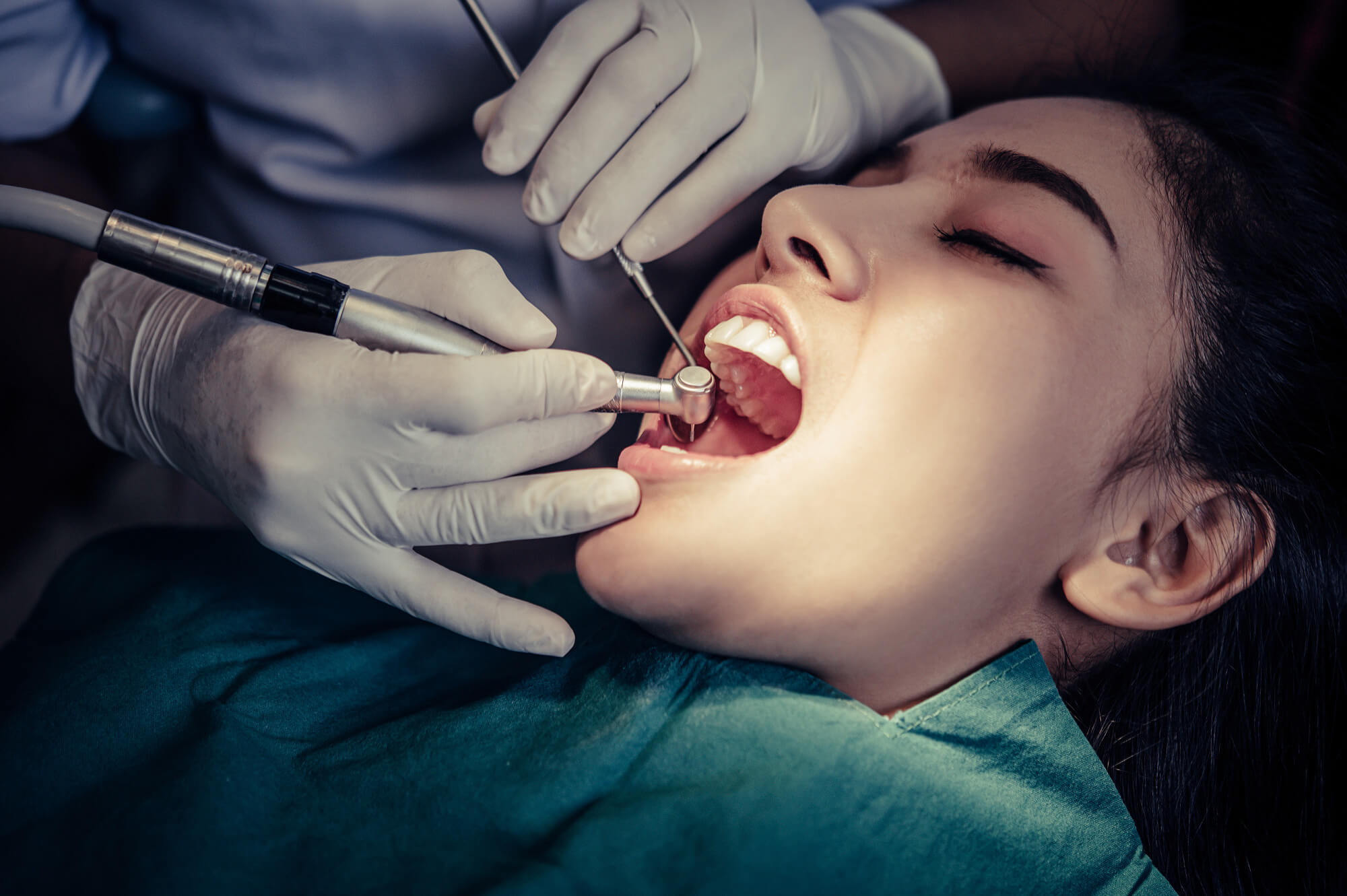 Dental Fillings in Anchorage, AK