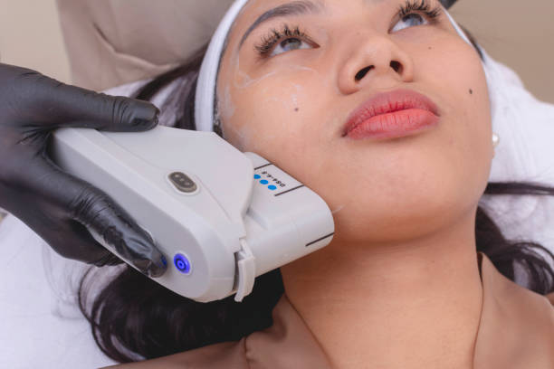 How HIFU Treatment Helps Lift Sagging Skin