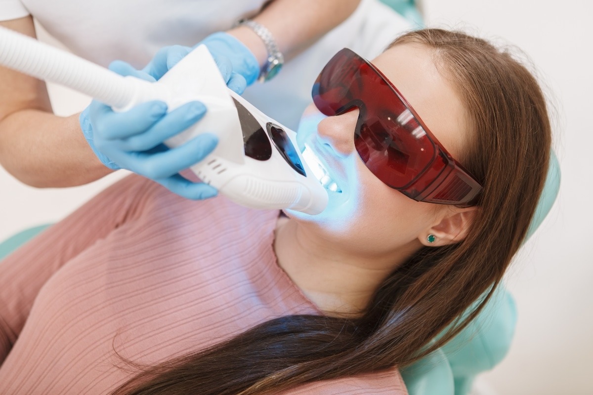 The Hidden Benefits of Laser Teeth Whitening You Did Not Know