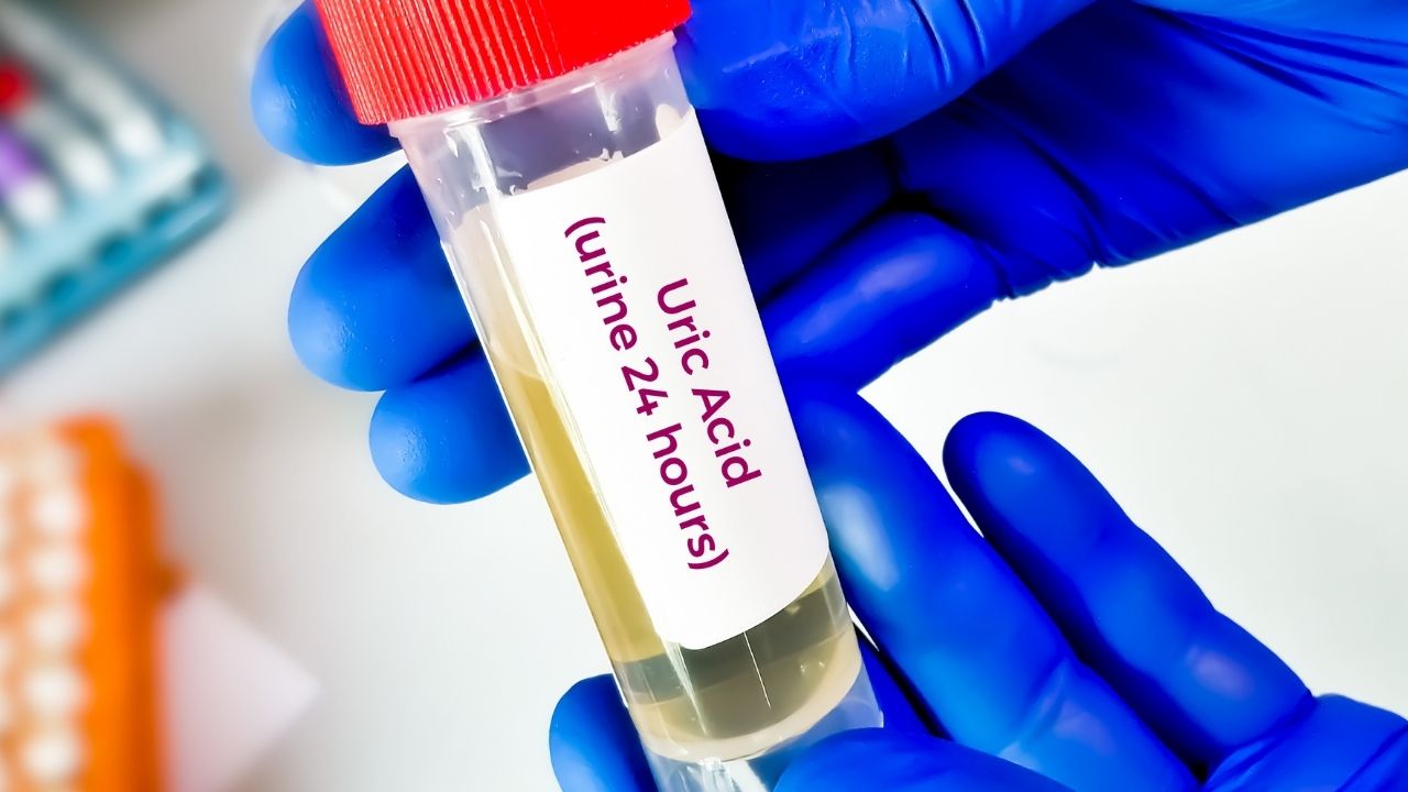 What are High and Low Uric Acid Levels in the Body