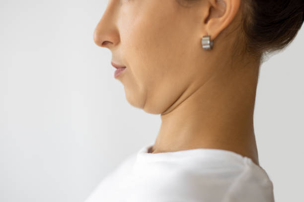 Does Double Chin Liposuction Give Instant Results?