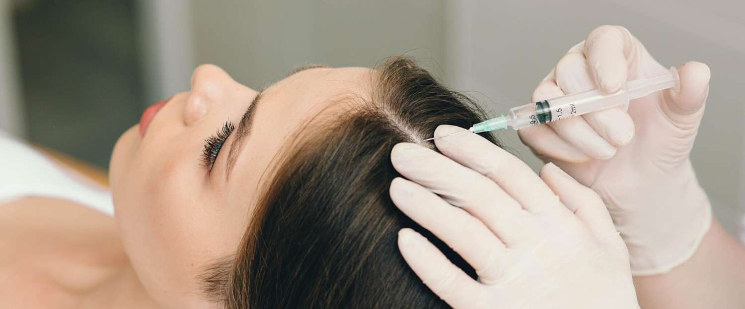 Exosomes for Hair Loss in Islamabad