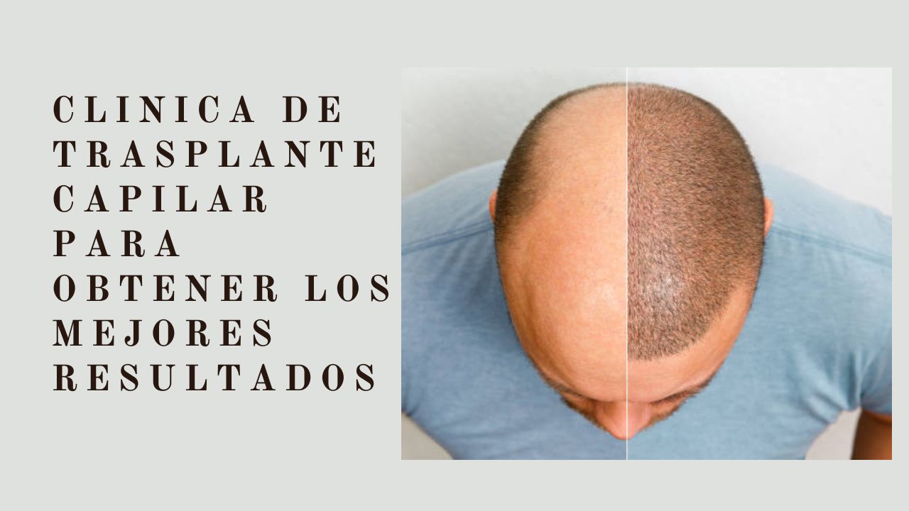 clinica de trasplante capilar