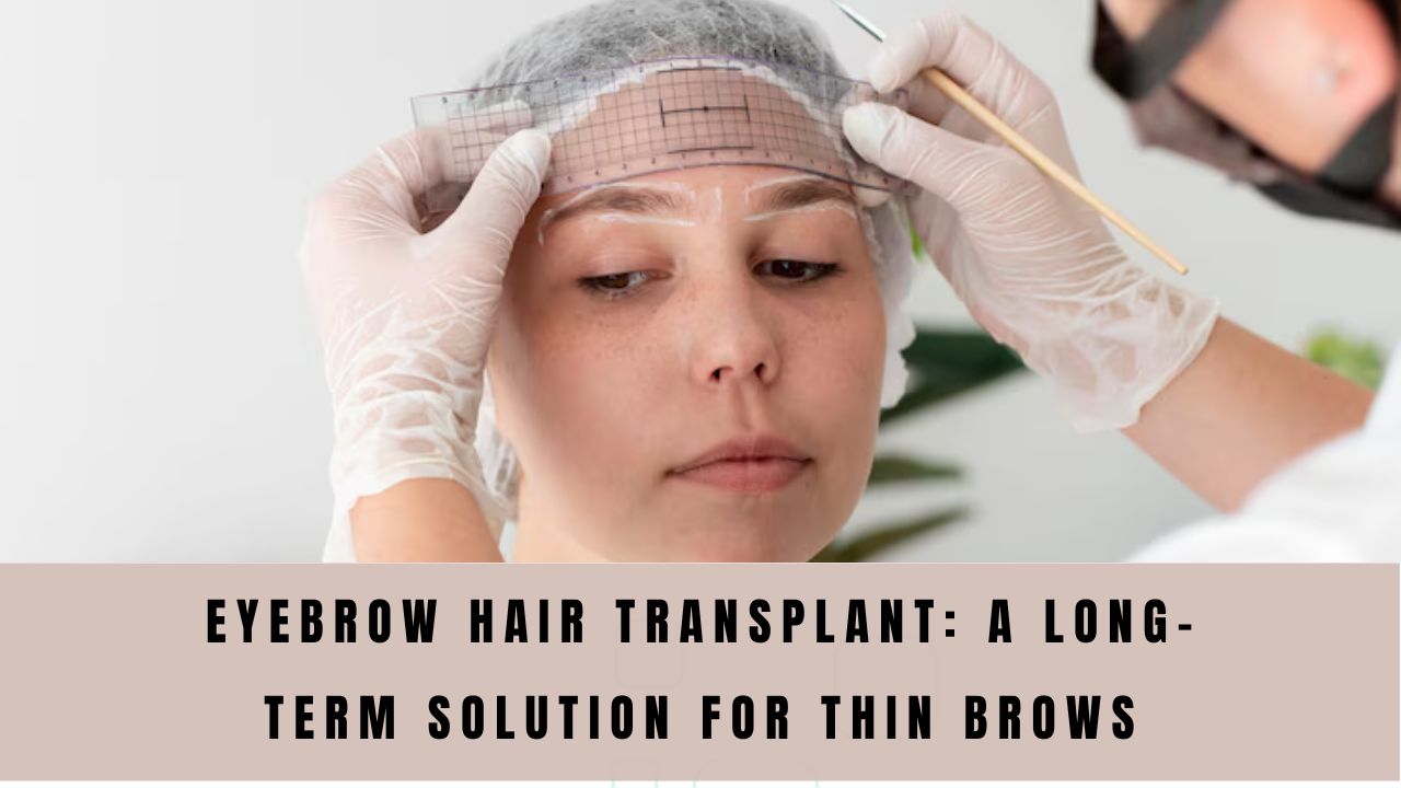 eyebrow hair transplant
